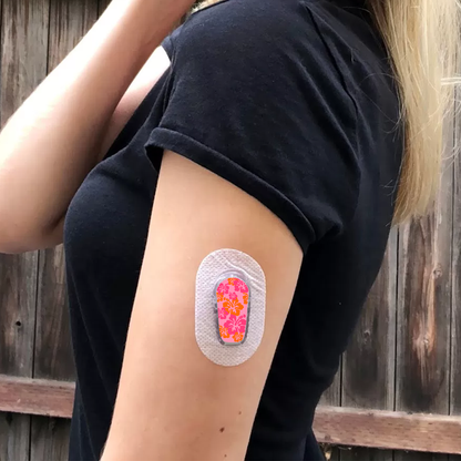 Tropical Flowers Dexcom G6 Transmitter Stickers - 6 Pack